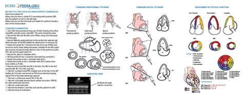 how to read echocardiogram